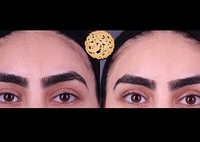 Comparison of two eyebrow styles on model.