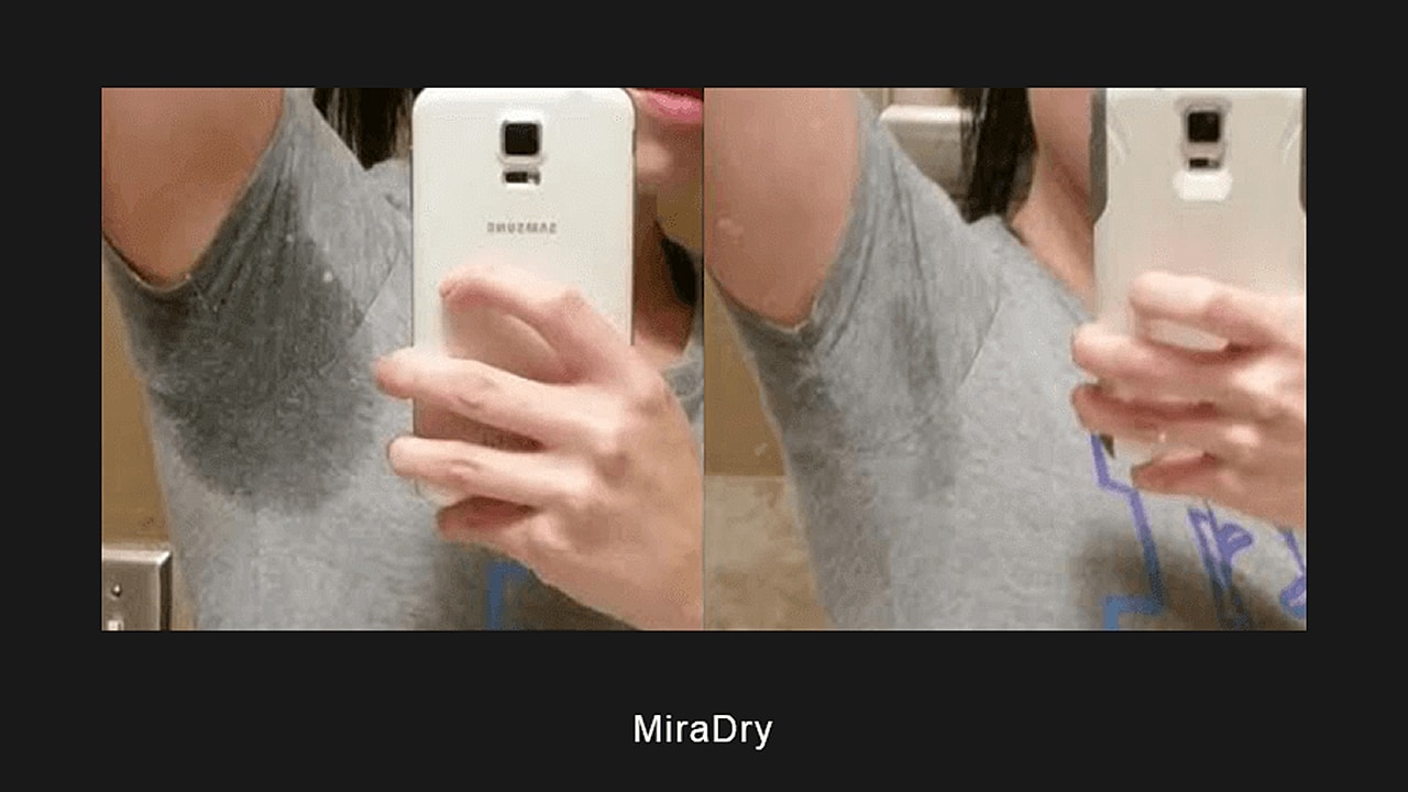 Comparison of underarm sweat before and after.
