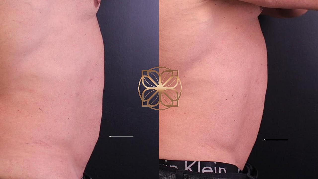 Injectables Gallery Before & After