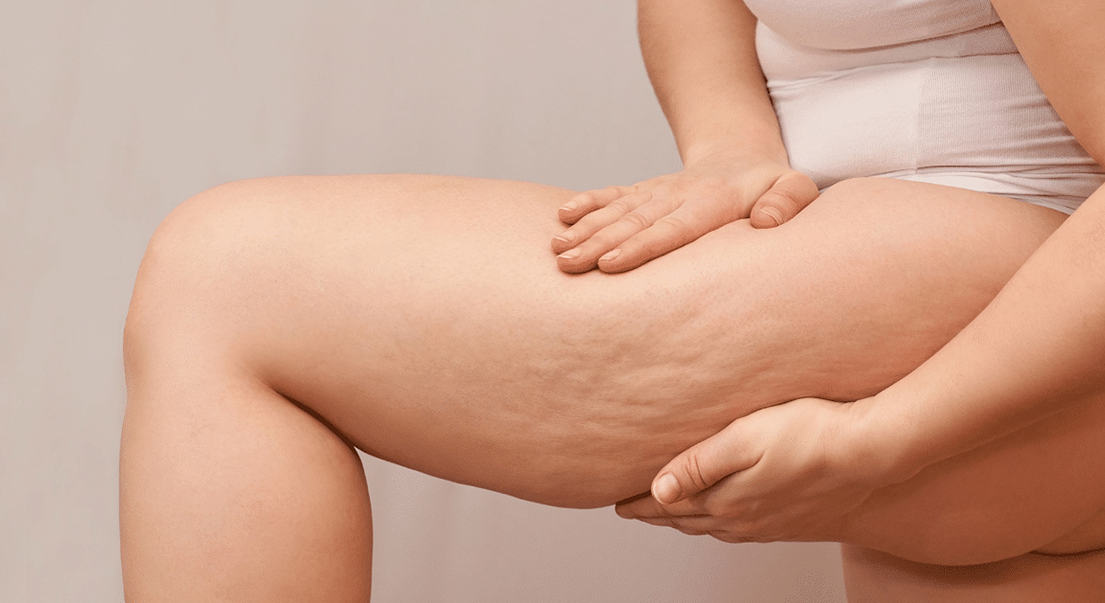 Person examining thigh with visible skin texture.